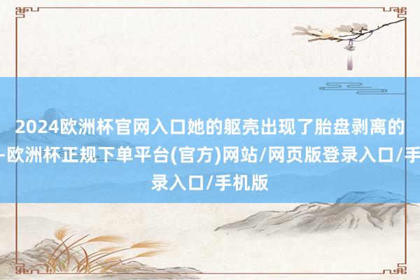 2024欧洲杯官网入口她的躯壳出现了胎盘剥离的症状-欧洲杯正规下单平台(官方)网站/网页版登录入口/手机版